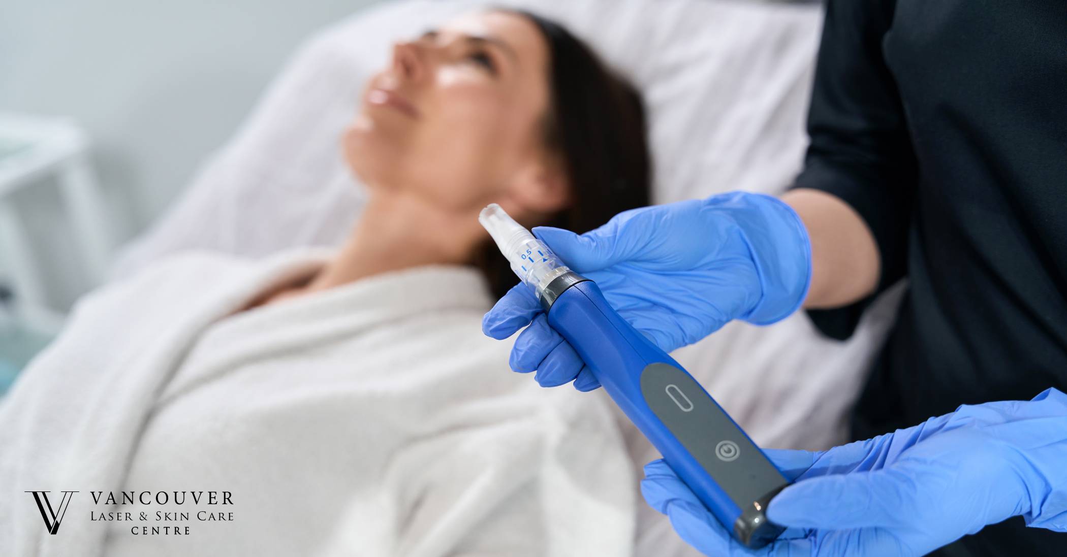 How Does Microneedling Work Exactly