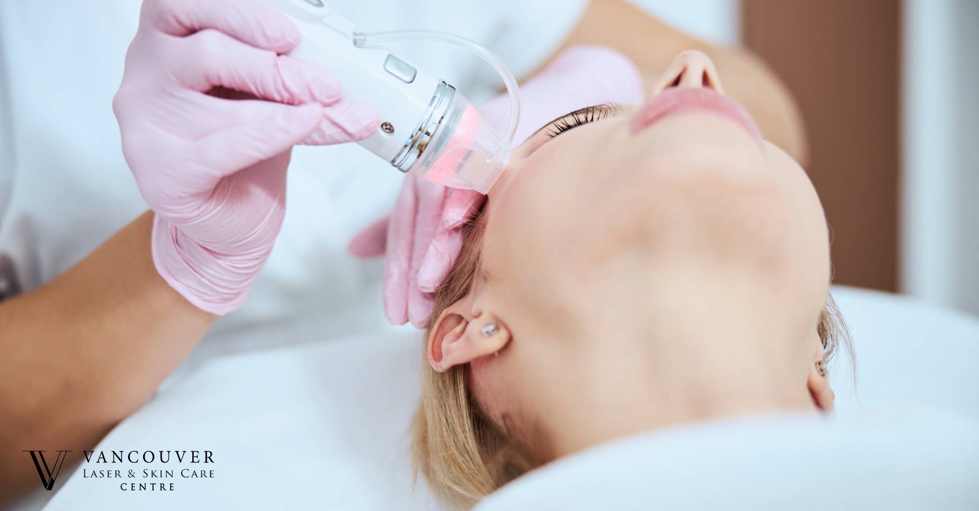 RF microneedling aftercare