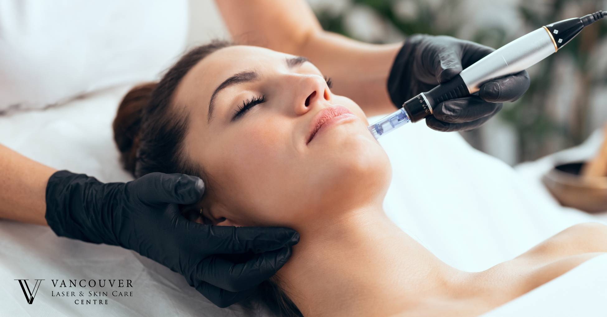 microneedling facial treatment