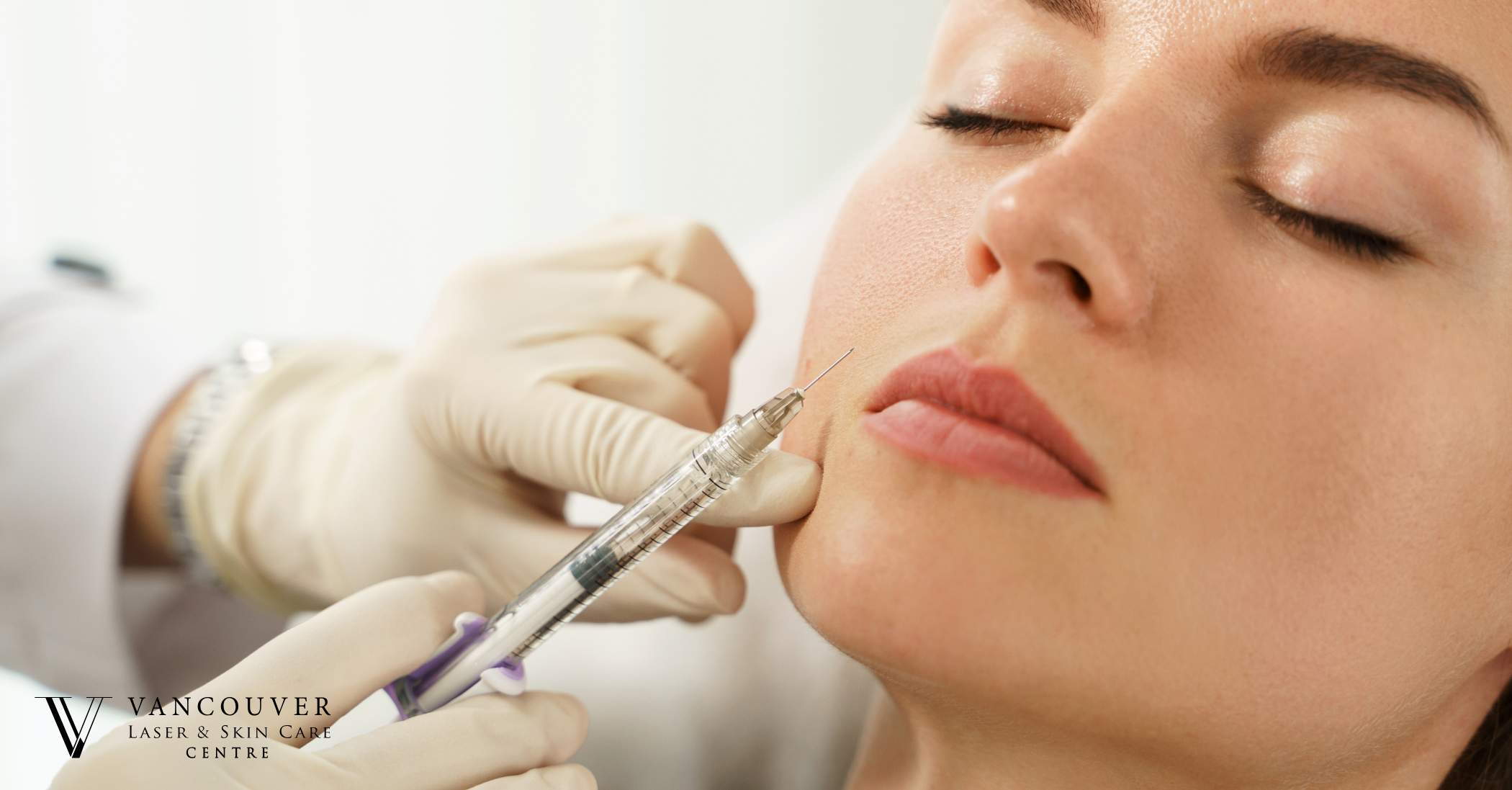 Gummy smile treatment
