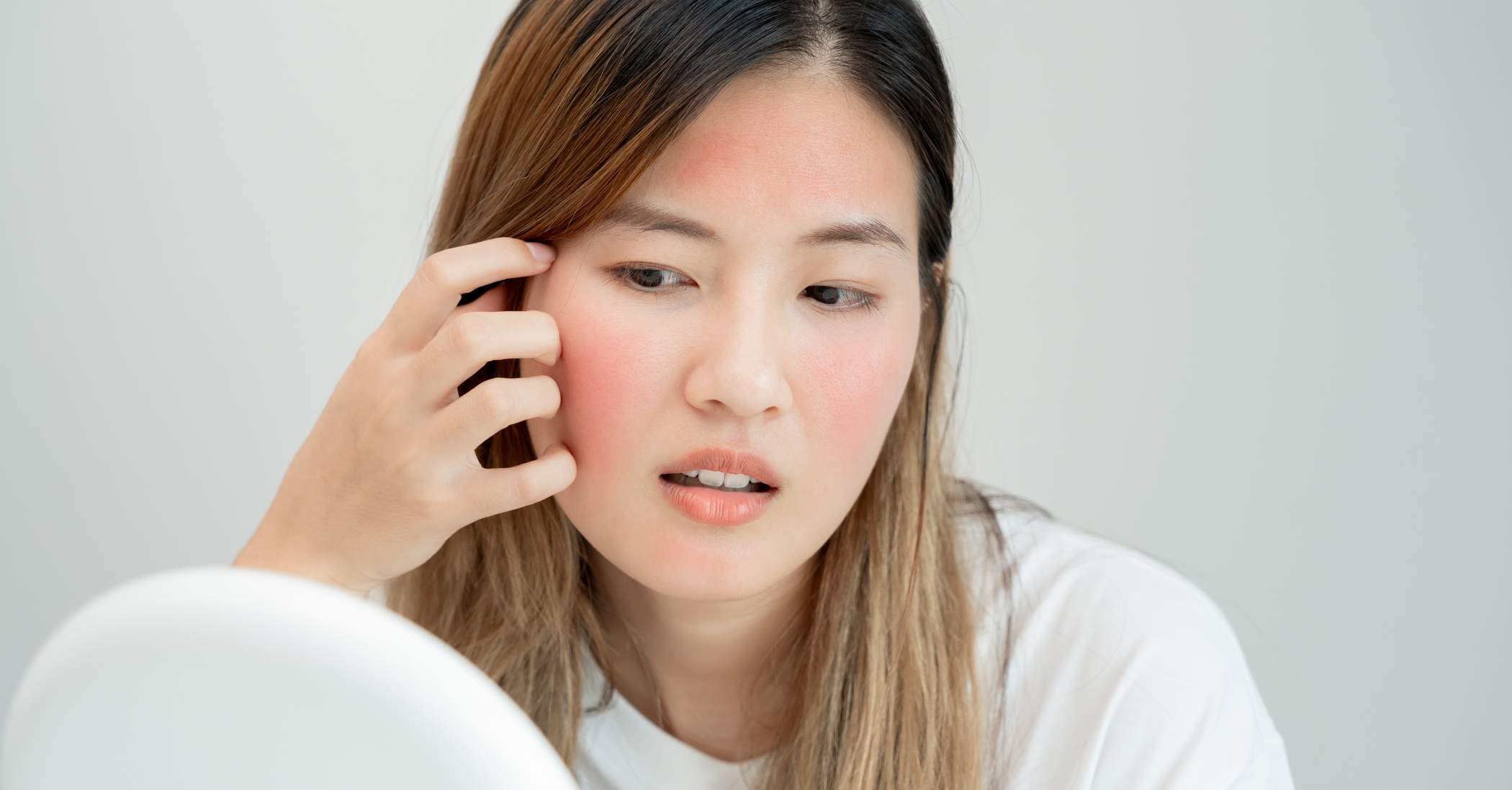 Common Symptoms of Rosacea and How to Treat Them