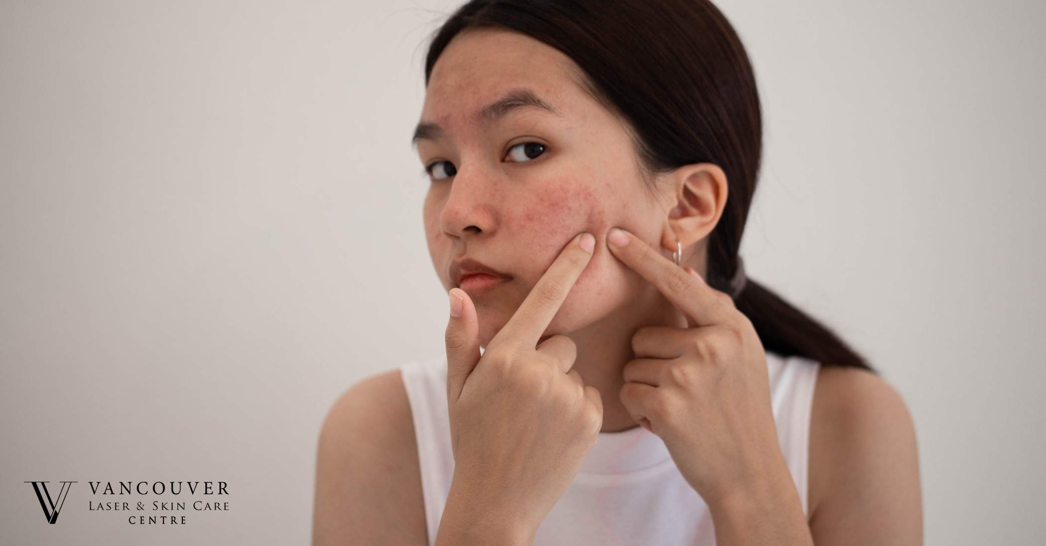 A woman examines her skin closely, focusing on areas affected by cystic acne.