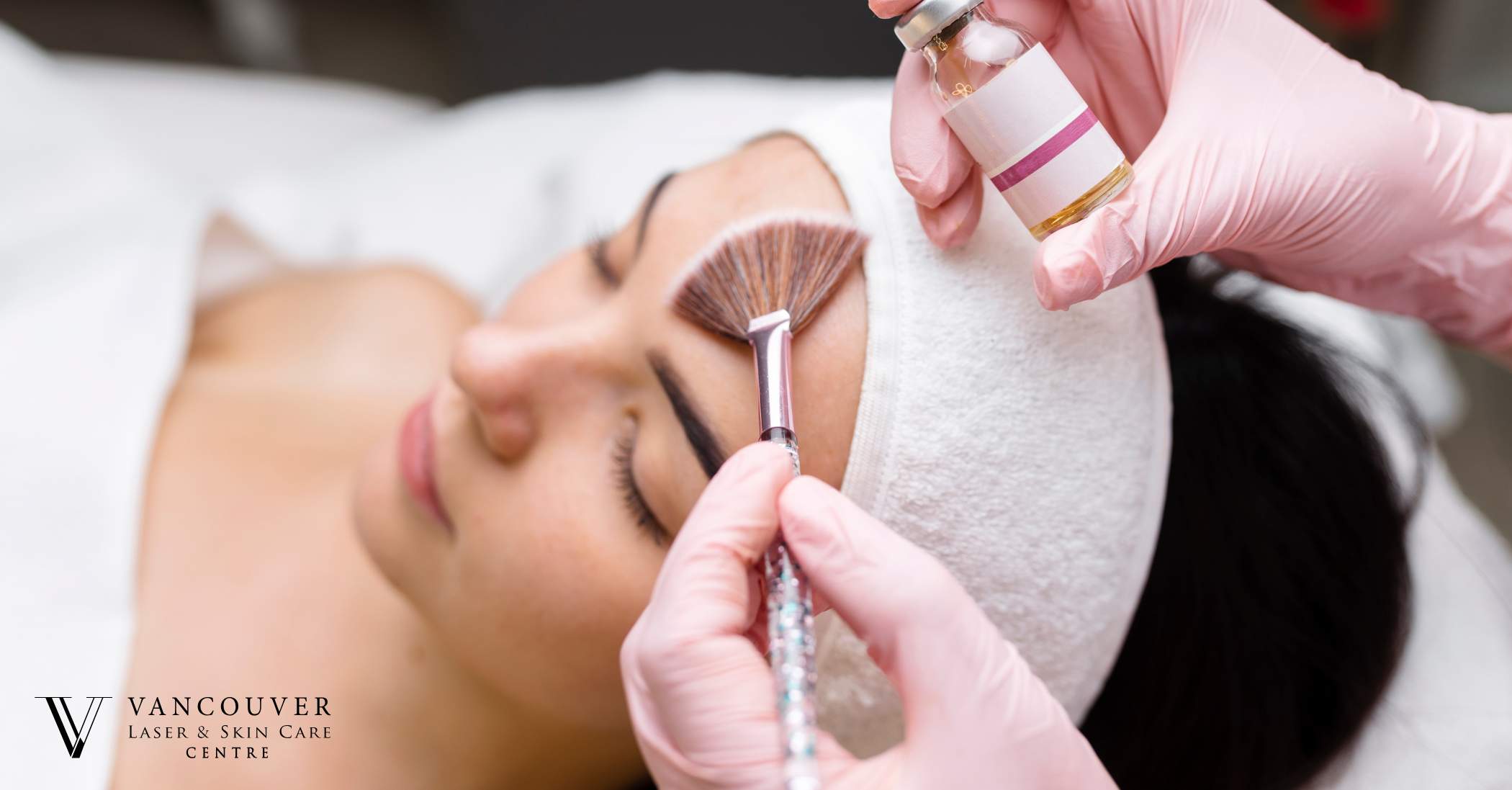Microdermabrasion vs Chemical Peel