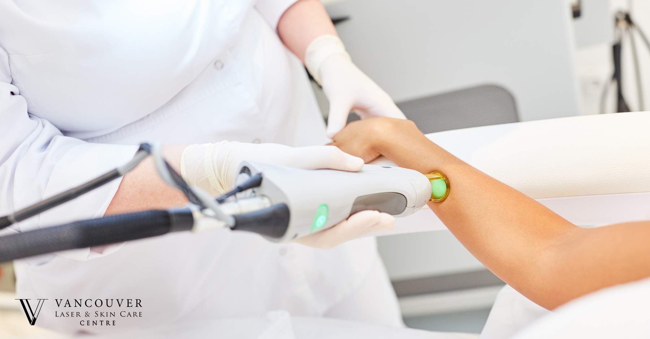 Precautions for laser hair removal at home