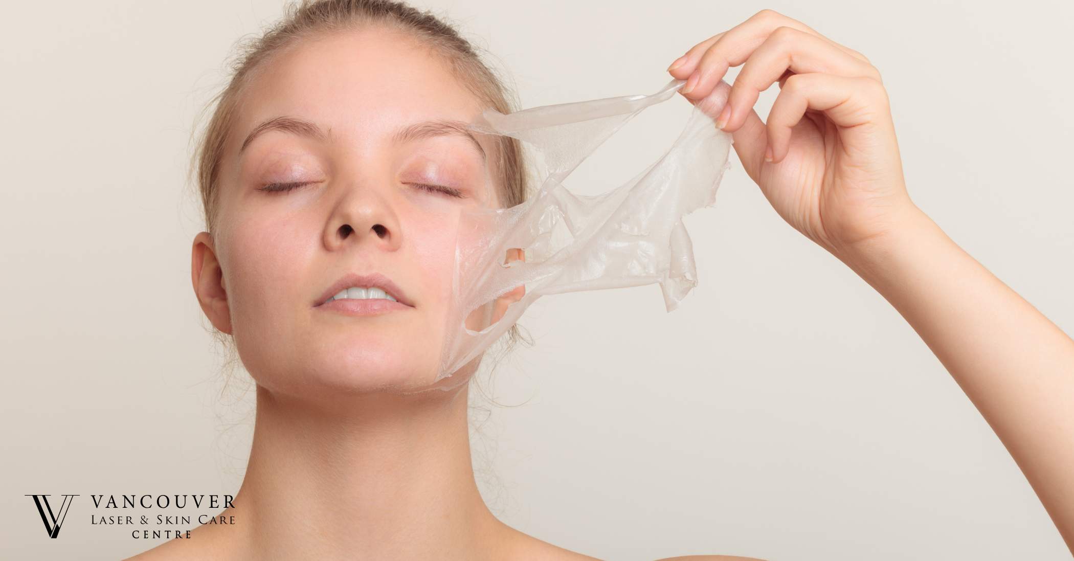 What Is a Chemical Peel