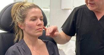 Private: Thread Lift